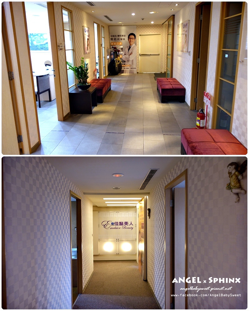 威塑超音波抽脂分享 - VASER威塑抽脂告別愛的把手馬鞍肉&雕塑腰窩 + 自體脂肪填補3.jpg 威塑超音波抽脂分享 - VASER威塑抽脂告別愛的把手馬鞍肉&雕塑腰窩 + 自體脂肪填補3.jpg