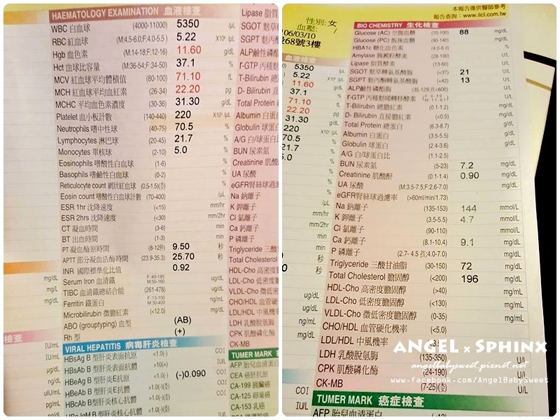 威塑超音波抽脂分享 - VASER威塑抽脂告別愛的把手馬鞍肉&雕塑腰窩 + 自體脂肪填補8.jpg 威塑超音波抽脂分享 - VASER威塑抽脂告別愛的把手馬鞍肉&雕塑腰窩 + 自體脂肪填補8.jpg