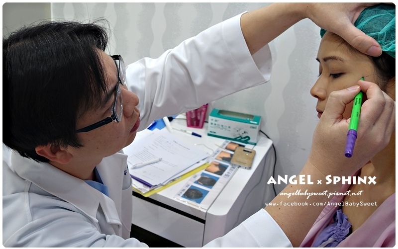 威塑超音波抽脂分享 - VASER威塑抽脂告別愛的把手馬鞍肉&雕塑腰窩 + 自體脂肪填補10.jpg 威塑超音波抽脂分享 - VASER威塑抽脂告別愛的把手馬鞍肉&雕塑腰窩 + 自體脂肪填補10.jpg