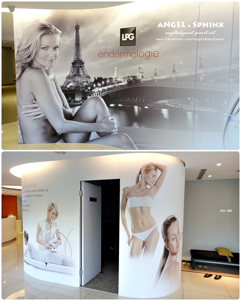 威塑超音波抽脂分享 - VASER威塑抽脂告別愛的把手馬鞍肉&雕塑腰窩 + 自體脂肪填補29.jpg 威塑超音波抽脂分享 - VASER威塑抽脂告別愛的把手馬鞍肉&雕塑腰窩 + 自體脂肪填補29.jpg