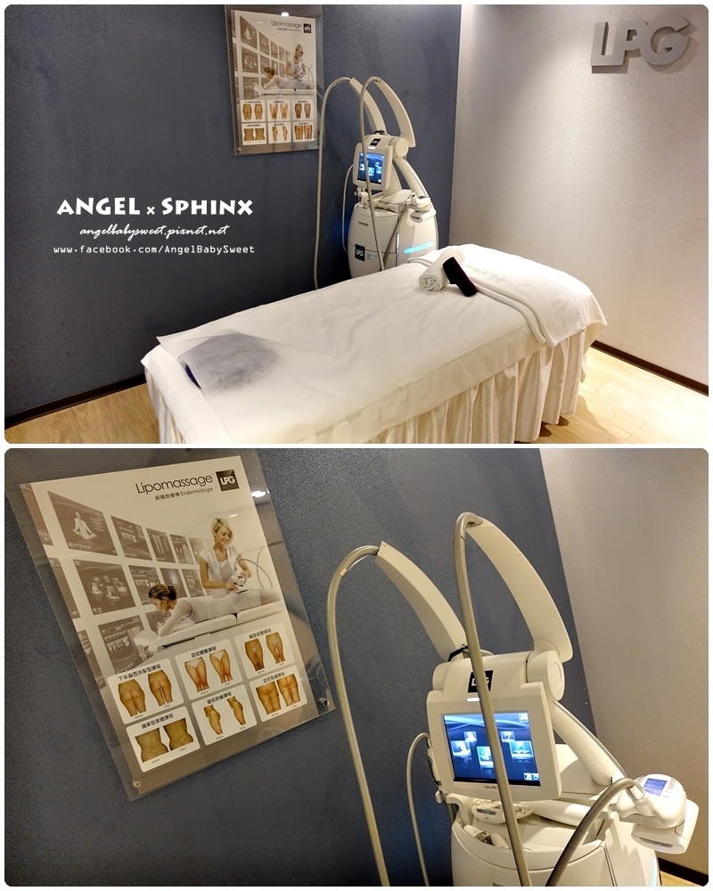 威塑超音波抽脂分享 - VASER威塑抽脂告別愛的把手馬鞍肉&雕塑腰窩 + 自體脂肪填補30.jpg 威塑超音波抽脂分享 - VASER威塑抽脂告別愛的把手馬鞍肉&雕塑腰窩 + 自體脂肪填補30.jpg