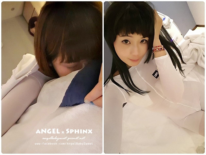 威塑超音波抽脂分享 - VASER威塑抽脂告別愛的把手馬鞍肉&雕塑腰窩 + 自體脂肪填補31.jpg 威塑超音波抽脂分享 - VASER威塑抽脂告別愛的把手馬鞍肉&雕塑腰窩 + 自體脂肪填補31.jpg