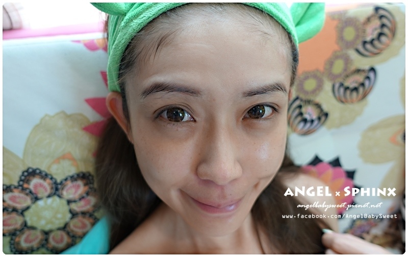 威塑超音波抽脂分享 - VASER威塑抽脂告別愛的把手馬鞍肉&雕塑腰窩 + 自體脂肪填補38.jpg 威塑超音波抽脂分享 - VASER威塑抽脂告別愛的把手馬鞍肉&雕塑腰窩 + 自體脂肪填補38.jpg