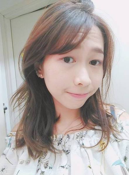 李兆翔醫師 - 小切口雙眼皮取脂合併眼神放大術(案例分享)4.JPG 李兆翔醫師 - 小切口雙眼皮取脂合併眼神放大術(案例分享)4.JPG