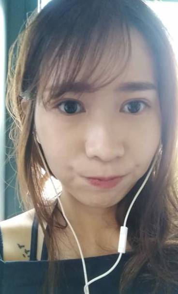 李兆翔醫師 - 小切口雙眼皮取脂合併眼神放大術(案例分享)5.JPG 李兆翔醫師 - 小切口雙眼皮取脂合併眼神放大術(案例分享)5.JPG