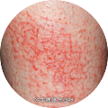 itch_02.png