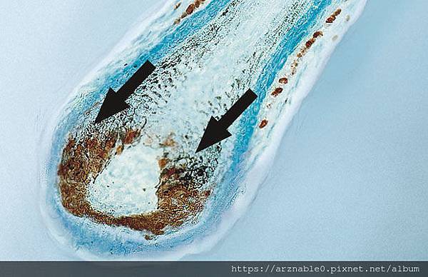 03_alpecin_energiemangel_haarwurzel.jpg 03_alpecin_energiemangel_haarwurzel.jpg