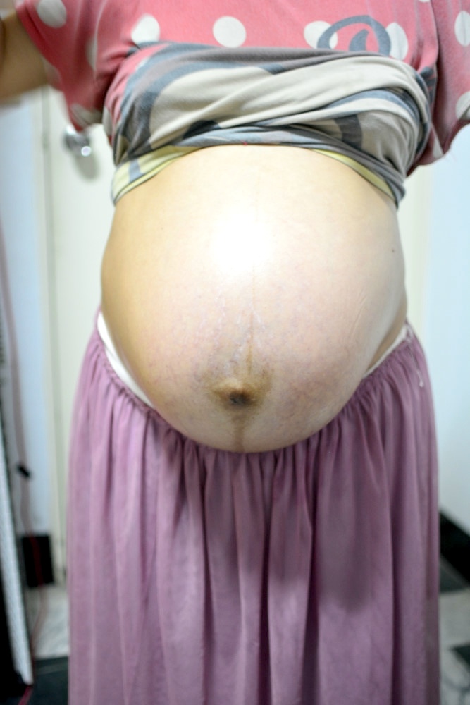 【孕肚保養】想擺脫妊娠紋～從預防做起！韓國tntn mom'