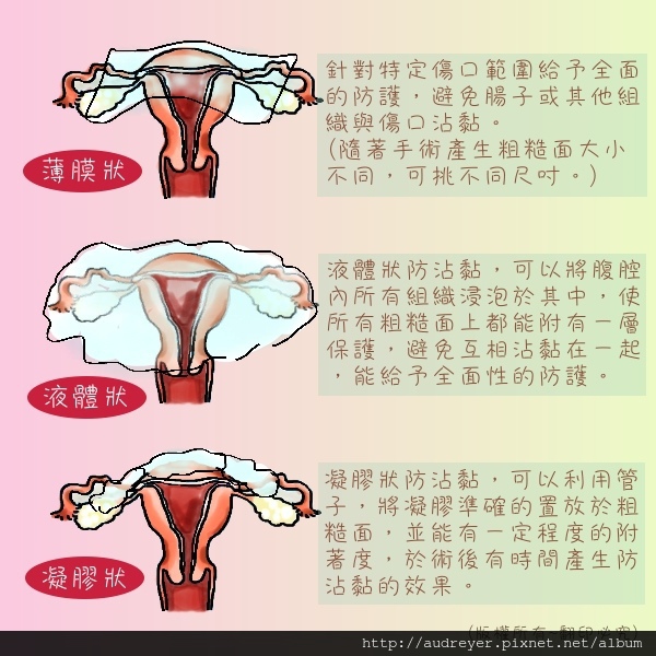 laparoscopic2.jpg