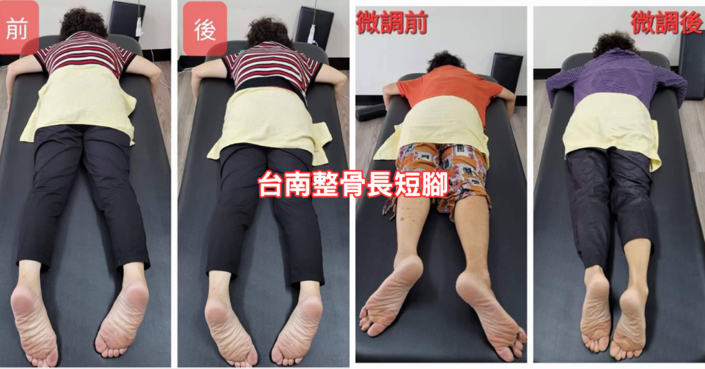 台南整骨推薦│元強專業仙骨微調│長短腳、骨盆歪斜不再是困擾│