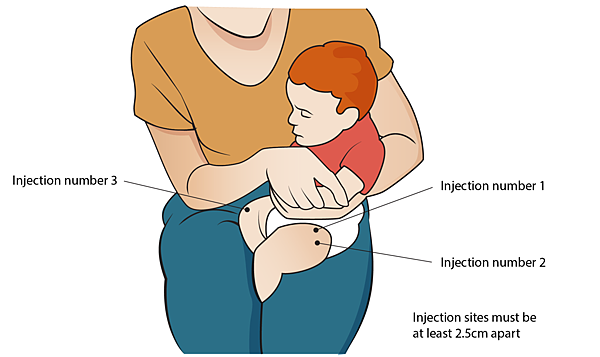 Giving-multiple-vaccines-into-anterolateral-thigh-infant-HR.png