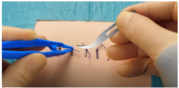 Minor Procedure 和術後拆線 ROS