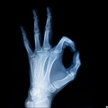 X-ray 37