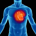 人類健康的威脅-心血管疾病