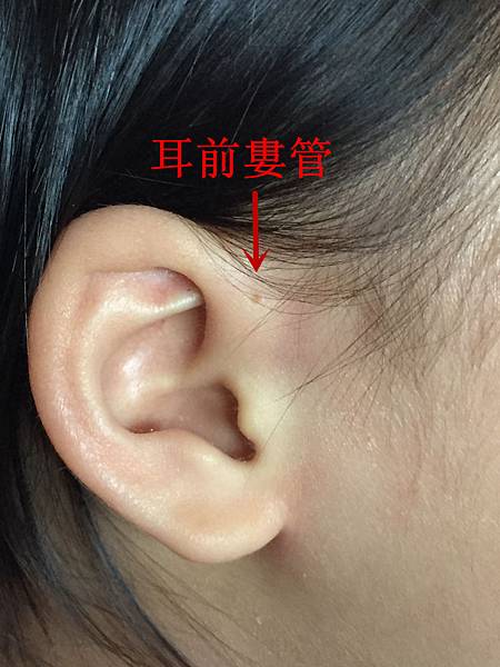 2Y5M19D-藥吃1month_副本2 2Y5M19D-藥吃1month_副本2