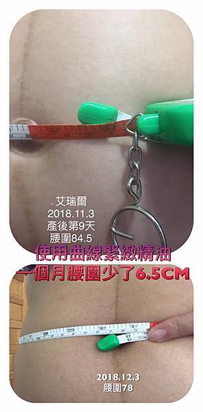鄒小姐產後曲線緊緻.jpg 鄒小姐產後曲線緊緻.jpg