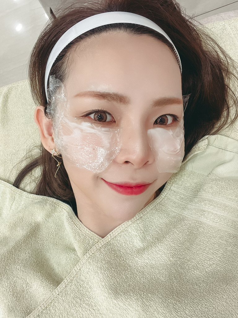 【台北醫美分享】佳飛雅醫美玻尿酸淚溝 找回年輕澎澎臉 讓我減