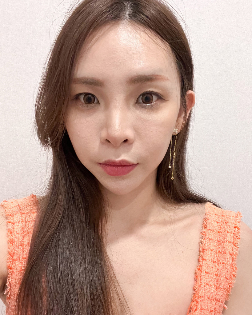 【台北醫美分享】佳飛雅醫美玻尿酸淚溝 找回年輕澎澎臉 讓我減