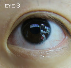 blog-eye3.jpg