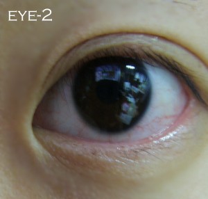 blog-eye2.jpg