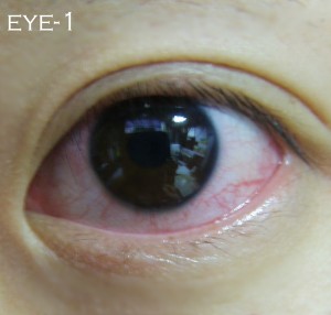 blog-eye1.jpg