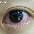 blog-eye1.jpg