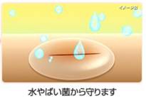 液體絆創膏 液體繃帶 正確使用方法 微笑藥師網 痞客邦
