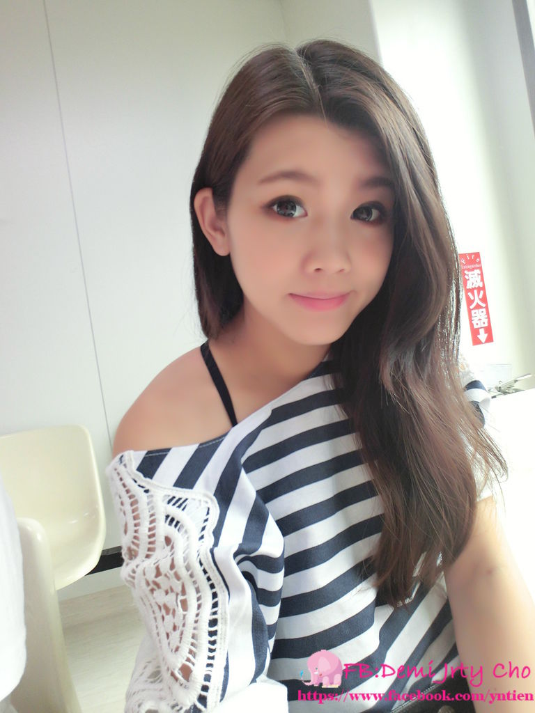 星采大安_敲鼻骨+耳軟骨墊鼻頭+卡麥拉三段式隆鼻_Demi02 星采大安_敲鼻骨+耳軟骨墊鼻頭+卡麥拉三段式隆鼻_Demi02