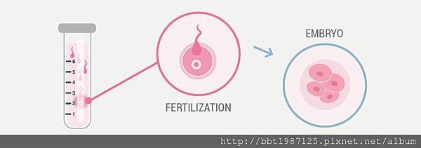 試管嬰兒受精卵著床過程