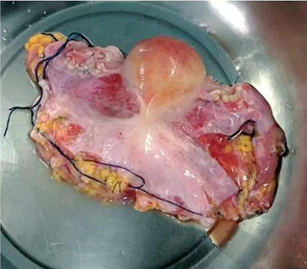 1544147182626.jpg 1544147182626.jpg