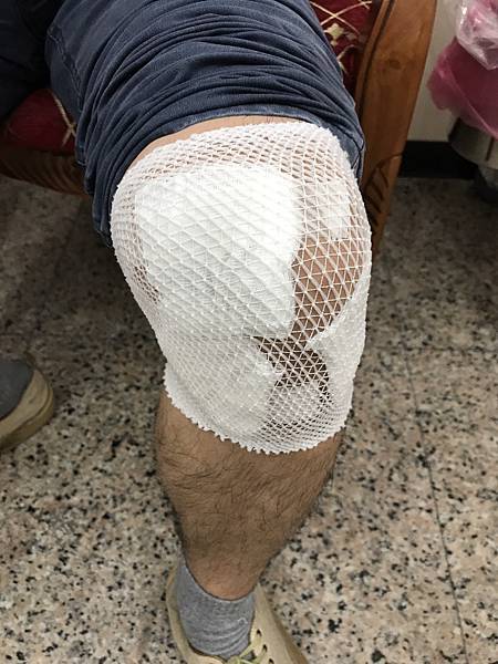 PRP關節注射 PRP關節注射