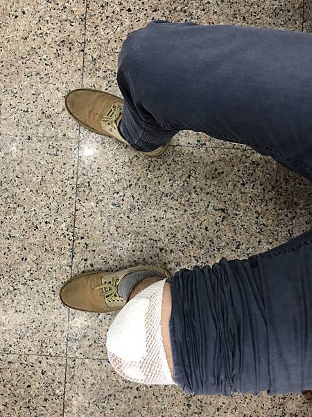 膝蓋關節疼痛 膝蓋關節疼痛