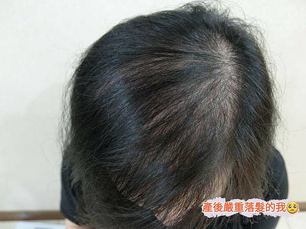 治療前.jpg 治療前.jpg