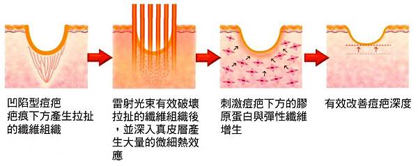 ãéºå§¿ çç¤ãçåçæå°çµæ