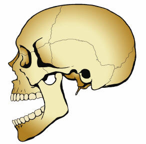 Mandibular Dislocation Mandibular Dislocation