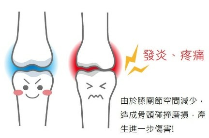 退化性關節炎治療、運動傷害治療