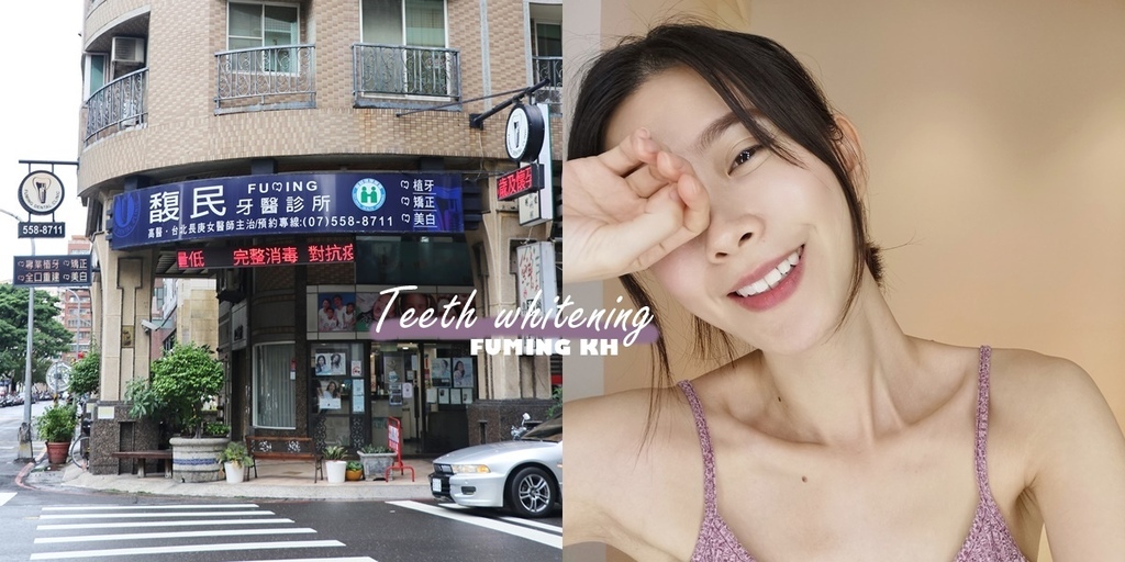 左營牙齒美白推薦:馥民牙醫 左營牙齒美白推薦:馥民牙醫