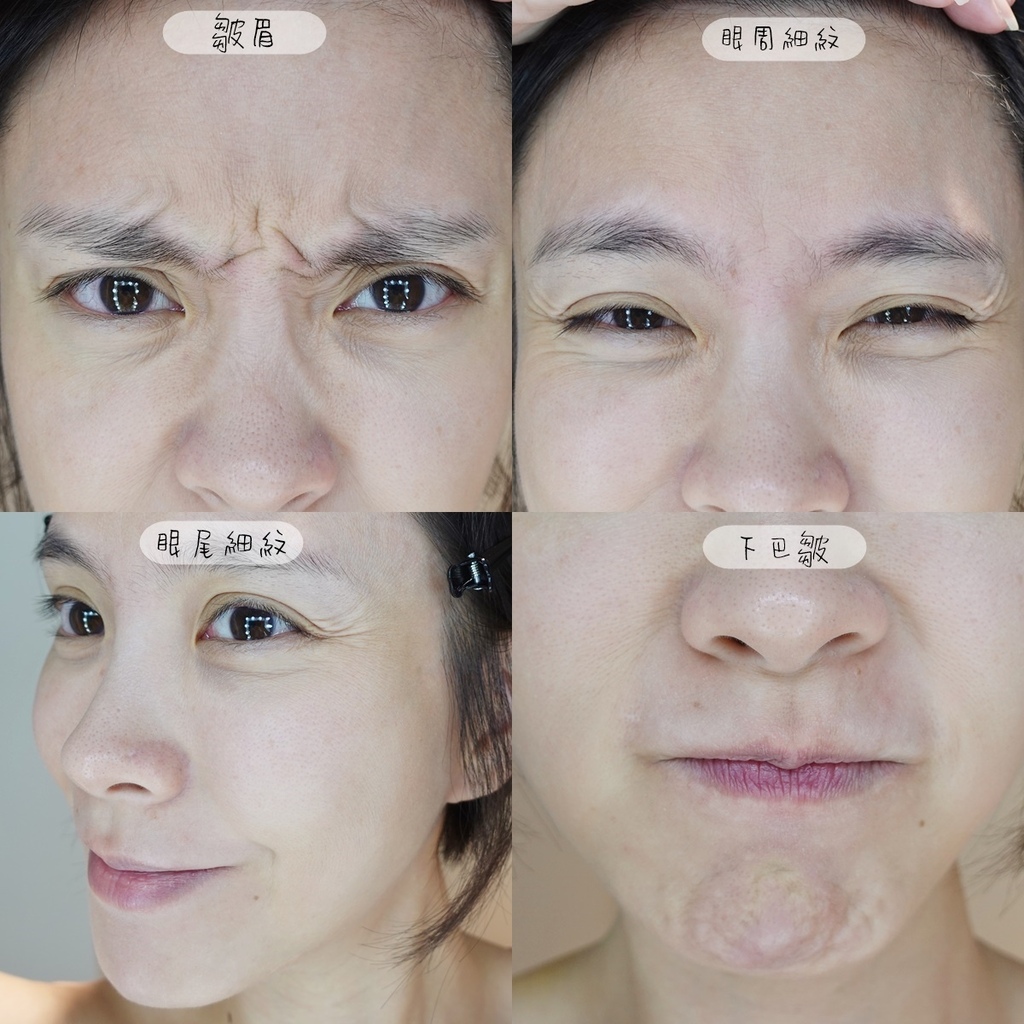 皺眉紋 眼尾細紋 皺眉紋 眼尾細紋