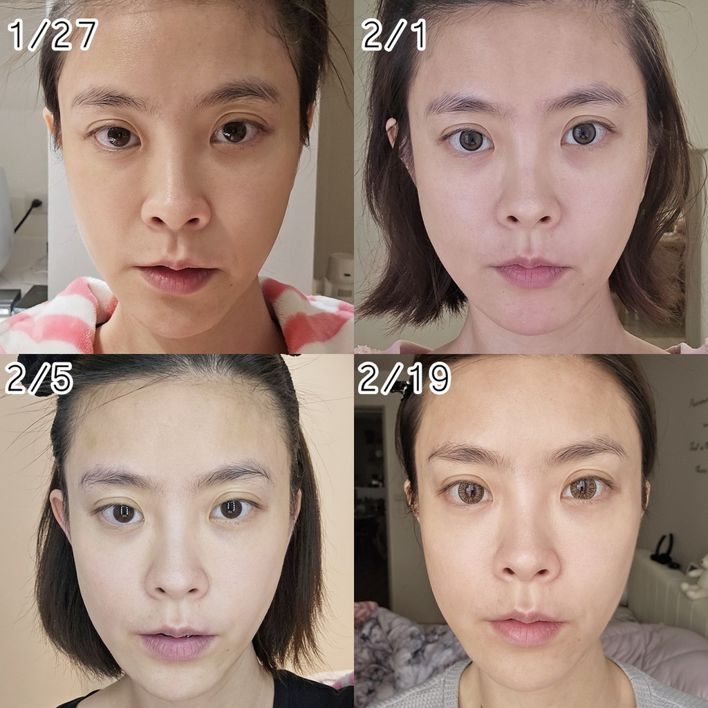 ZIIP HALO 美肤仪