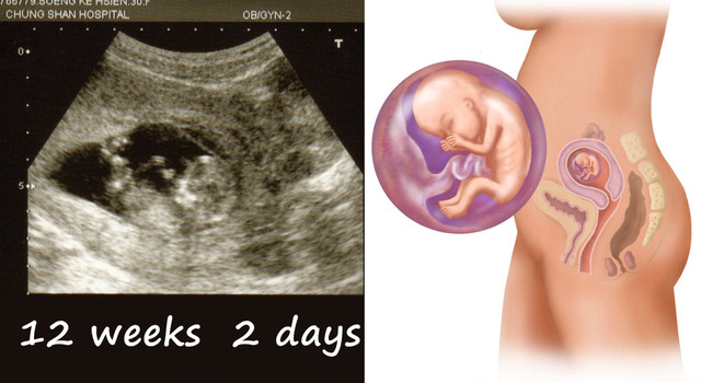 懷孕胎動x高層次超音波 貝姬becky 痞客邦