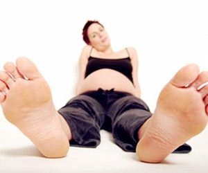 懷孕-水腫.jpg 懷孕-水腫.jpg