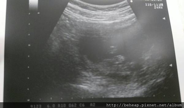 3/23 11周初見五根手指頭