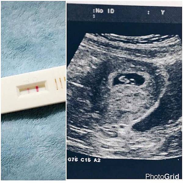 超開心的兩條線 超開心的兩條線