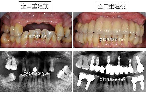 投影片12