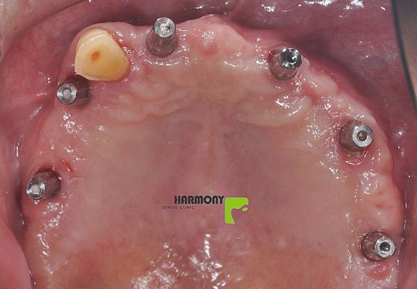 林清石1070803 (4).JPG