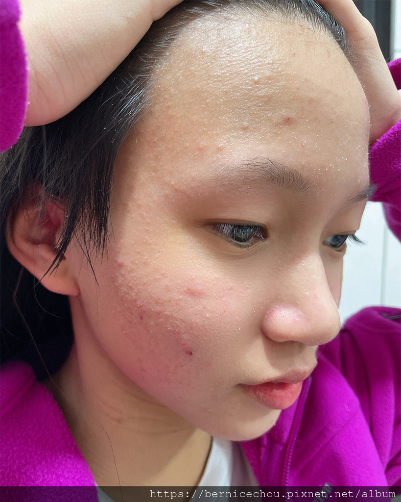 medicube積雪草修護爽膚棉+積雪草修護精華16.jpg medicube積雪草修護爽膚棉+積雪草修護精華16.jpg