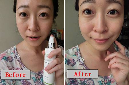 粉刺代謝噴霧 粉刺代謝噴霧