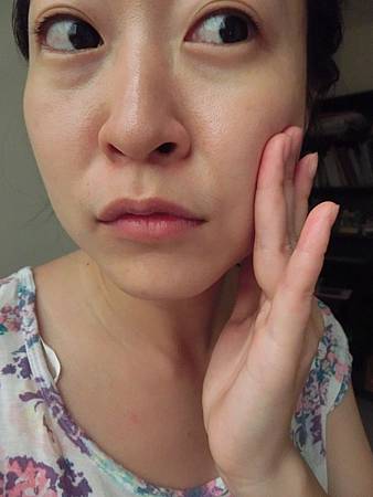 粉刺代謝噴霧 粉刺代謝噴霧