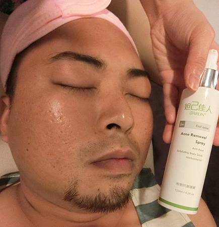 粉刺代謝噴霧 粉刺代謝噴霧