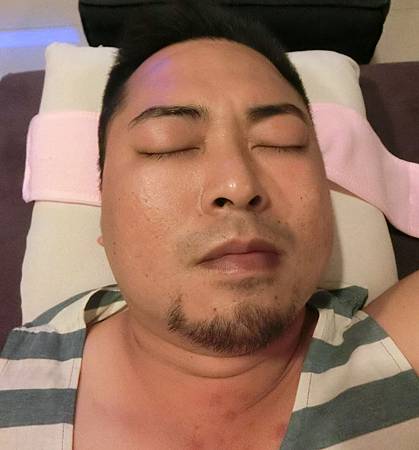 粉刺代謝噴霧 粉刺代謝噴霧